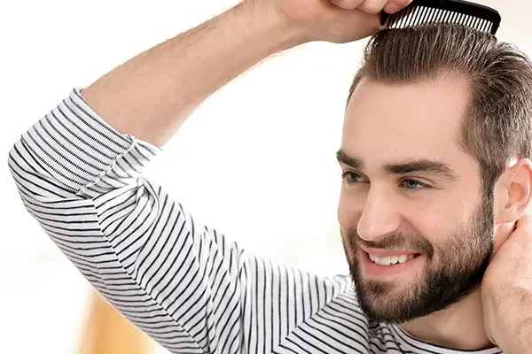 Trasplante Capilar – Injerto Capilar