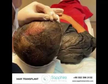 Sapphire Hair Clinic