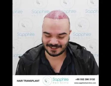 Sapphire Hair Clinic