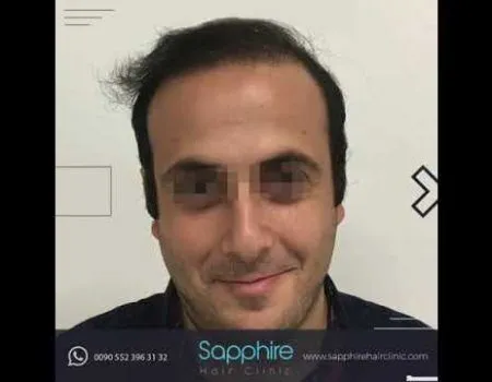 Sapphire Hair Clinic