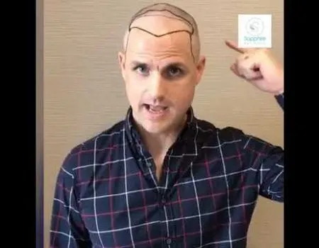 Sapphire Hair Clinic