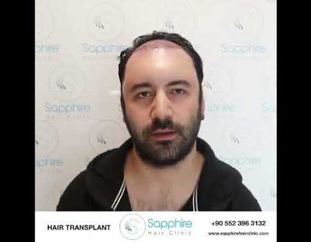 Sapphire Hair Clinic