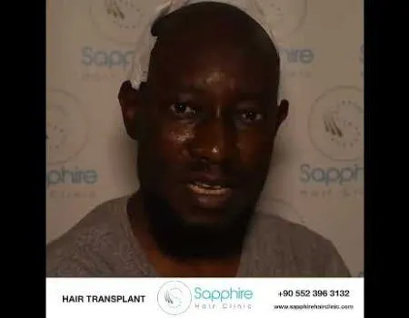 Sapphire Hair Clinic