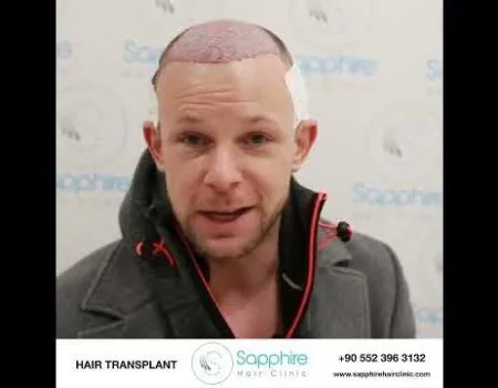 Sapphire Hair Clinic