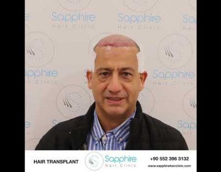 Sapphire Hair Clinic
